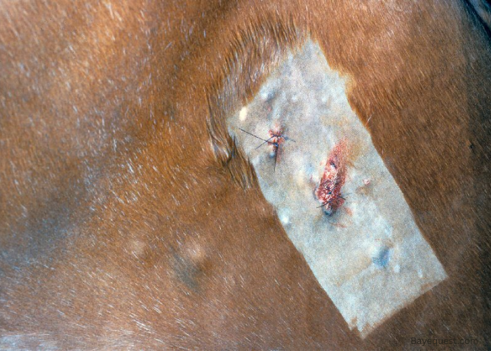 Eosinophilic Granulomas